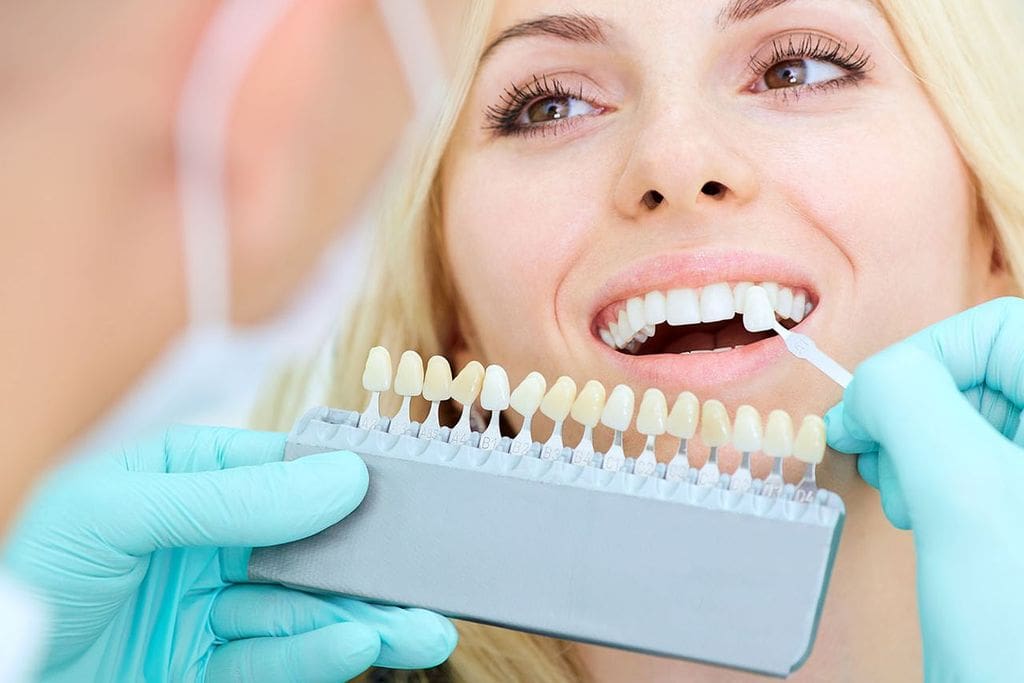 Porcelain Veneers in Winchester, VA