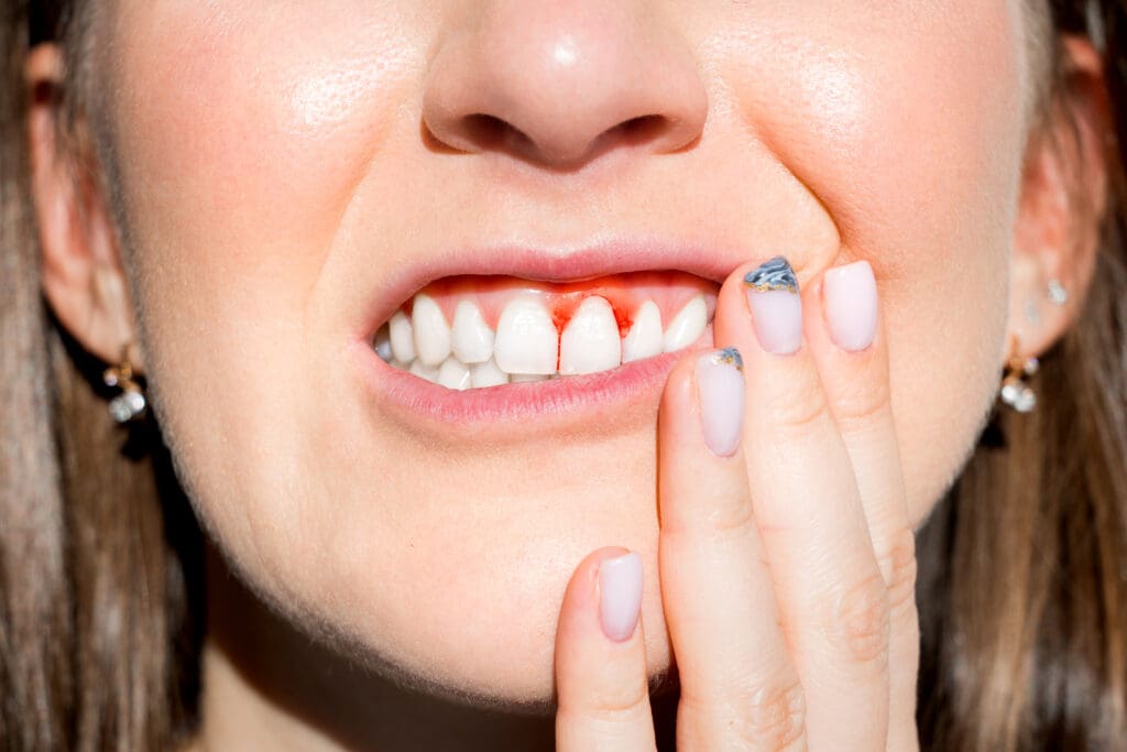 Periodontal Disease Treatment in Winchester VA